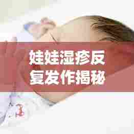 娃娃湿疹反复发作揭秘，原因、对策及日常护理全攻略