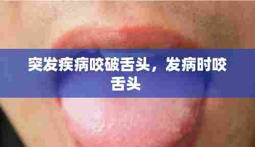 突发疾病咬破舌头,发病时咬舌头