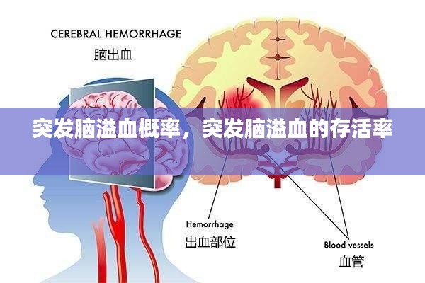 突发脑溢血概率，突发脑溢血的存活率 