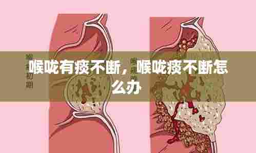 喉咙有痰不断,喉咙痰不断怎么办