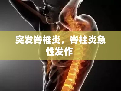 突发脊椎炎，脊柱炎急性发作 